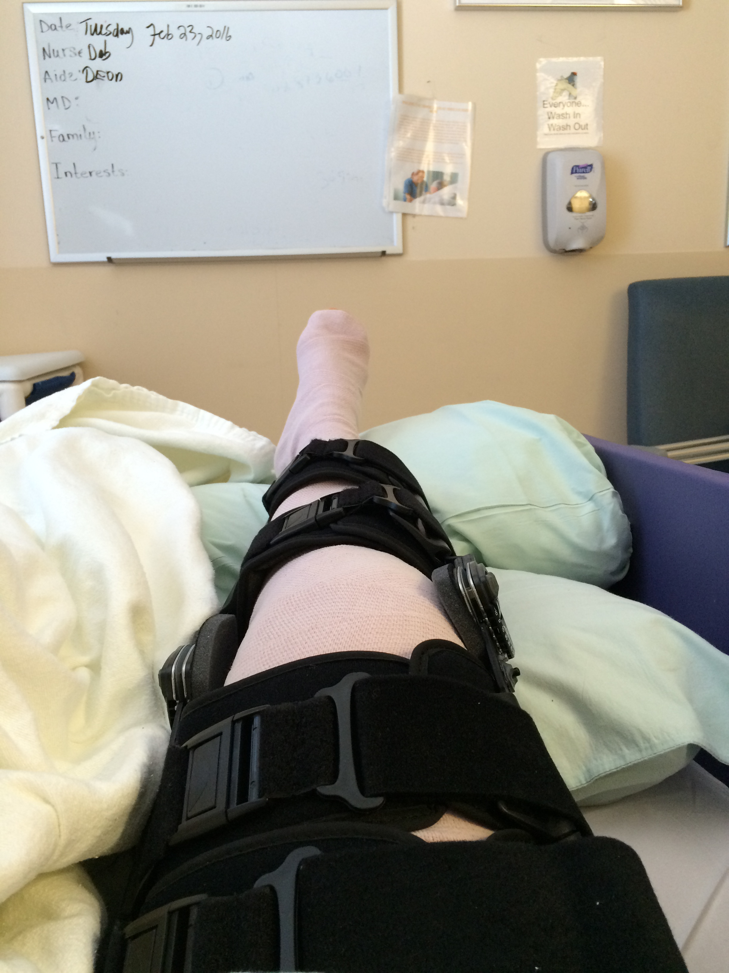 Fractured Tibial Plateau. 2.23.16